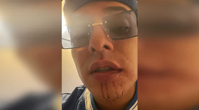 EFE BABY sufre violento asalto frente a su domicilio tras ofrecer show en REINA ROJA